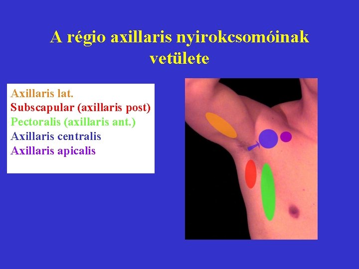 A régio axillaris nyirokcsomóinak vetülete Axillaris lat. Subscapular (axillaris post) Pectoralis (axillaris ant. )