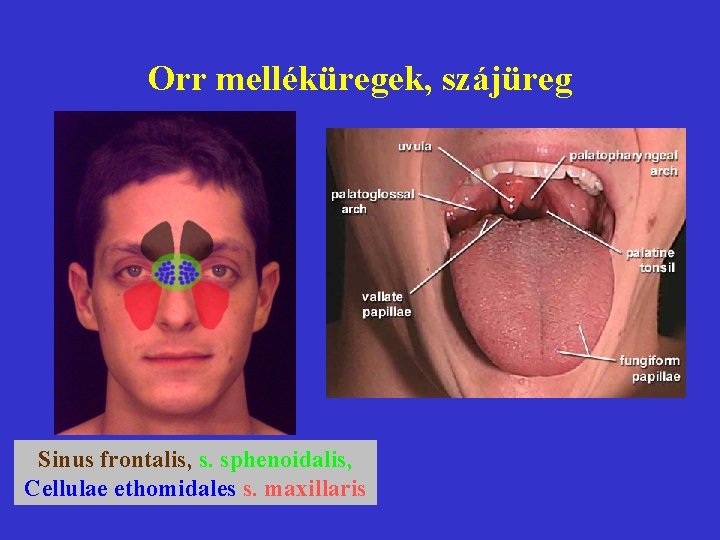 Orr melléküregek, szájüreg Sinus frontalis, s. sphenoidalis, Cellulae ethomidales s. maxillaris 