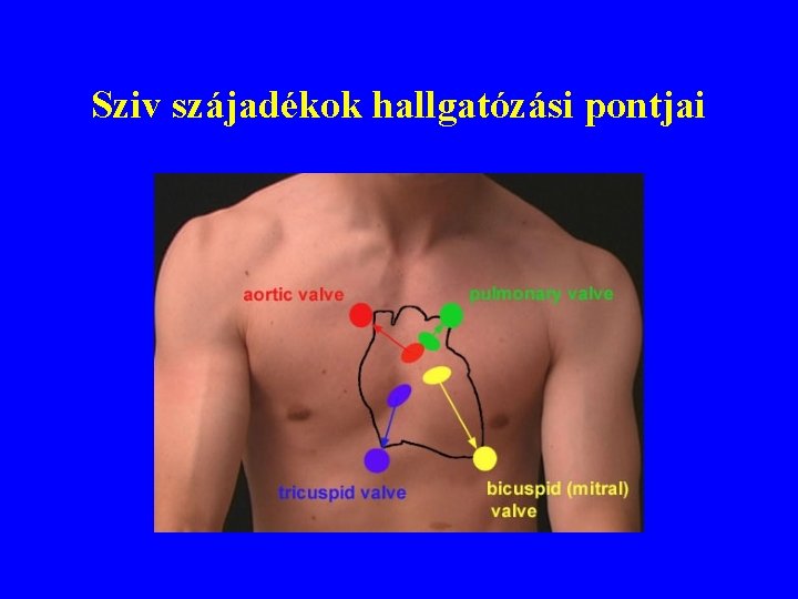 Sziv szájadékok hallgatózási pontjai 