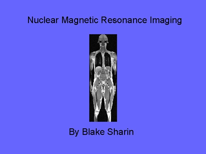 Nuclear Magnetic Resonance Imaging By Blake Sharin 