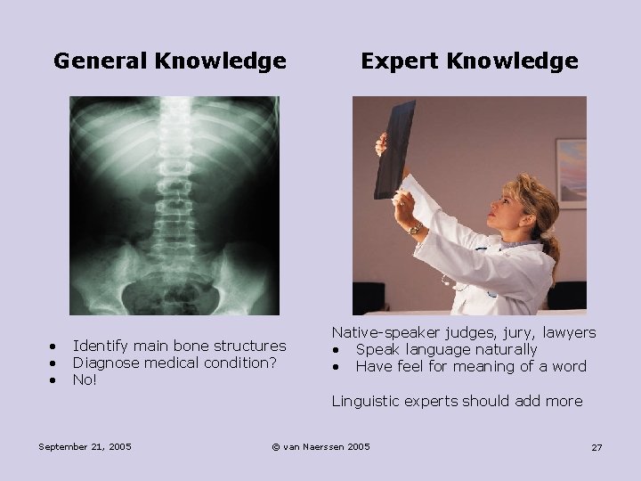General Knowledge • • • Identify main bone structures Diagnose medical condition? No! Expert