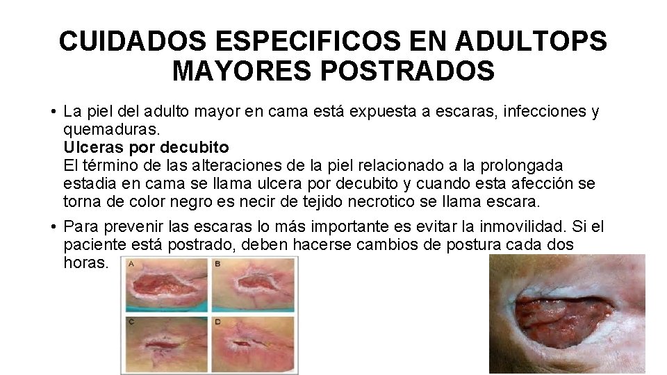 CUIDADOS ESPECIFICOS EN ADULTOPS MAYORES POSTRADOS • La piel del adulto mayor en cama