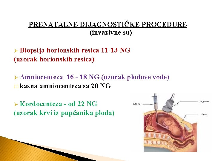 PRENATALNE DIJAGNOSTIČKE PROCEDURE (invazivne su) Biopsija horionskih resica 11 -13 NG (uzorak horionskih resica)