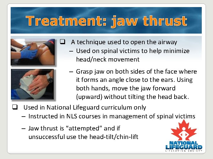 Treatment: jaw thrust q A technique used to open the airway – Used on Treatment: jaw thrust q A technique used to open the airway – Used on