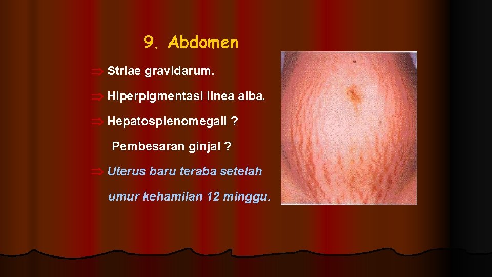 9. Abdomen Striae gravidarum. Hiperpigmentasi linea alba. Hepatosplenomegali ? Pembesaran ginjal ? Uterus baru 9. Abdomen Striae gravidarum. Hiperpigmentasi linea alba. Hepatosplenomegali ? Pembesaran ginjal ? Uterus baru