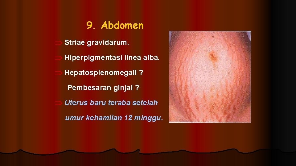 9. Abdomen Striae gravidarum. Hiperpigmentasi linea alba. Hepatosplenomegali ? Pembesaran ginjal ? Uterus baru