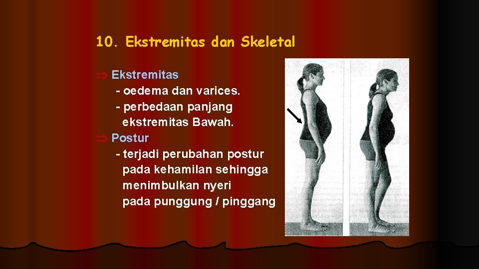 10. Ekstremitas dan Skeletal Ekstremitas - oedema dan varices. - perbedaan panjang ekstremitas Bawah.