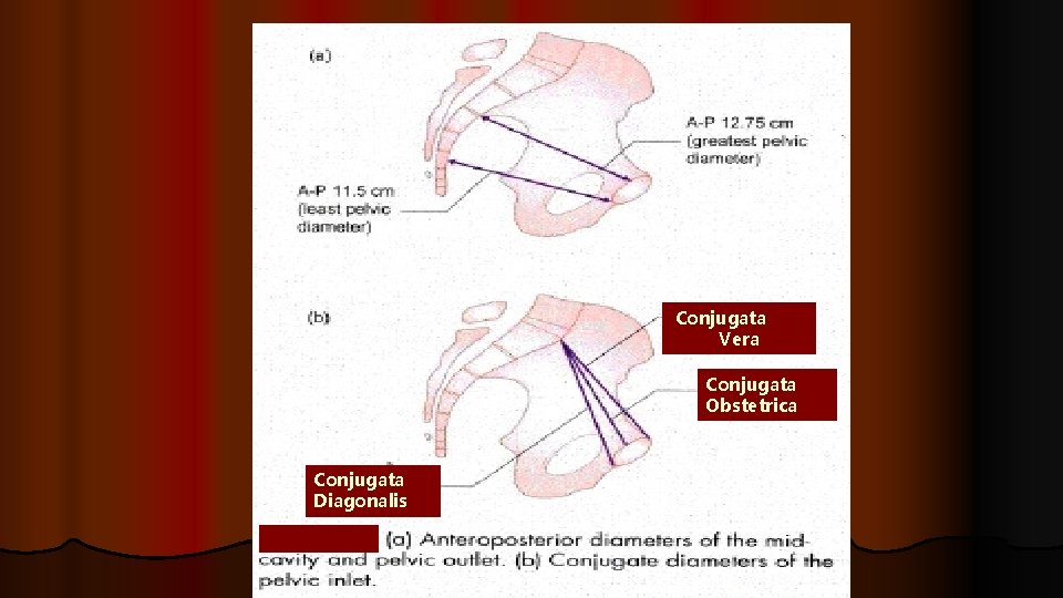 Conjugata Vera Conjugata Obstetrica Conjugata Diagonalis 