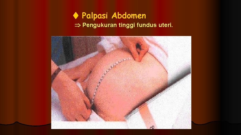 Palpasi Abdomen Pengukuran tinggi fundus uteri. 