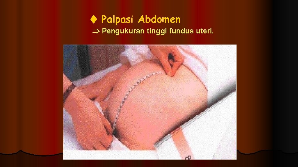 Palpasi Abdomen Pengukuran tinggi fundus uteri. Palpasi Abdomen Pengukuran tinggi fundus uteri.