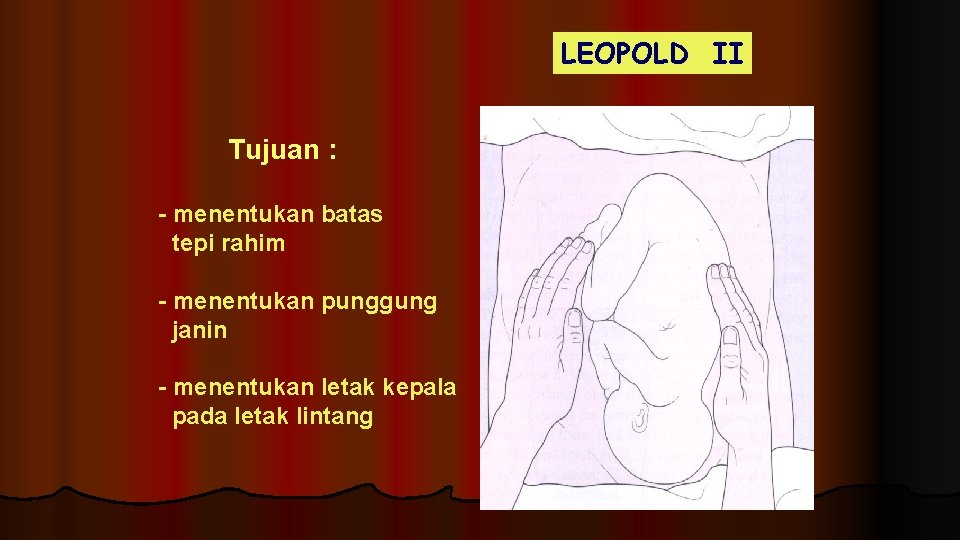 LEOPOLD II Tujuan : - menentukan batas tepi rahim - menentukan punggung janin -