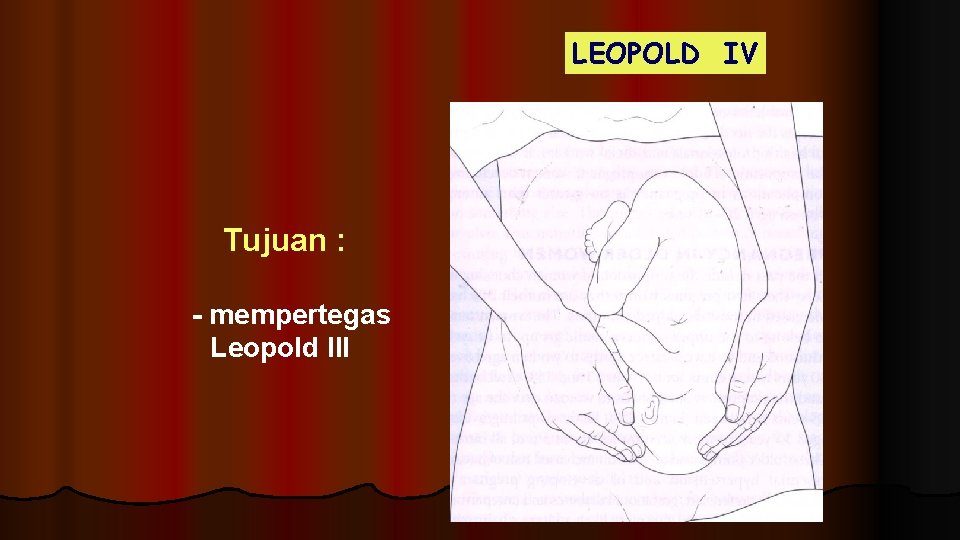 LEOPOLD IV Tujuan : - mempertegas Leopold III 