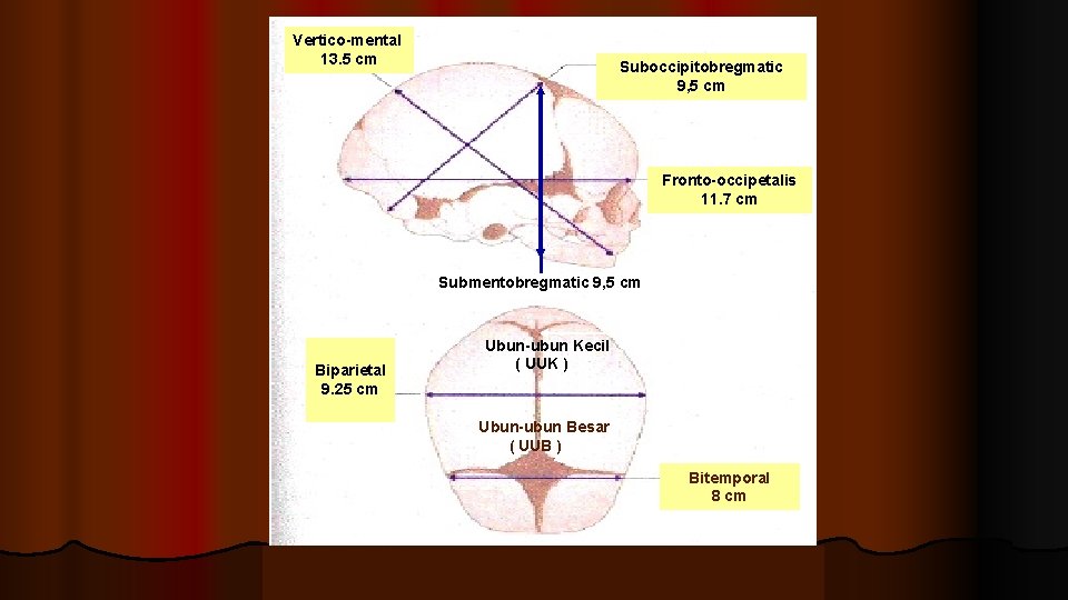 Vertico-mental 13. 5 cm Suboccipitobregmatic 9, 5 cm Fronto-occipetalis 11. 7 cm Submentobregmatic 9, Vertico-mental 13. 5 cm Suboccipitobregmatic 9, 5 cm Fronto-occipetalis 11. 7 cm Submentobregmatic 9,