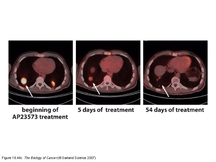 Figure 16. 44 c The Biology of Cancer (© Garland Science 2007) 