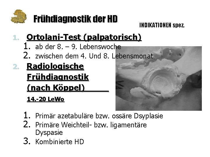 Frühdiagnostik der HD 1. 2. INDIKATIONEN spez. Ortolani-Test (palpatorisch) 1. 2. ab der 8.