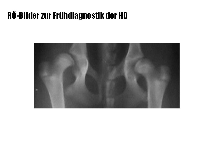 RÖ-Bilder zur Frühdiagnostik der HD 24 Wochen – DSH 