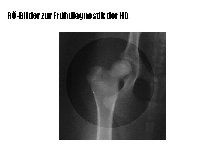 RÖ-Bilder zur Frühdiagnostik der HD 24 Wochen – Labrador 