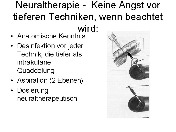 Neuraltherapie - Keine Angst vor tieferen Techniken, wenn beachtet wird: • Anatomische Kenntnis •