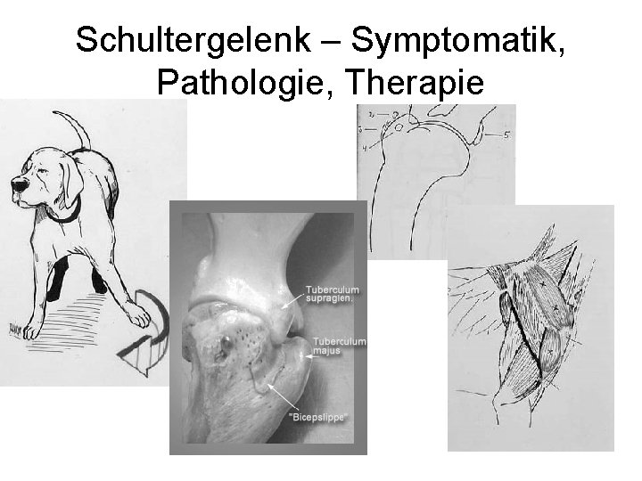 Schultergelenk – Symptomatik, Pathologie, Therapie 