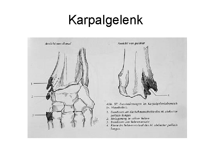 Karpalgelenk 