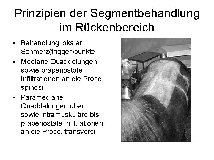 Prinzipien der Segmentbehandlung im Rückenbereich • Behandlung lokaler Schmerz(trigger)punkte • Mediane Quaddelungen sowie präperiostale