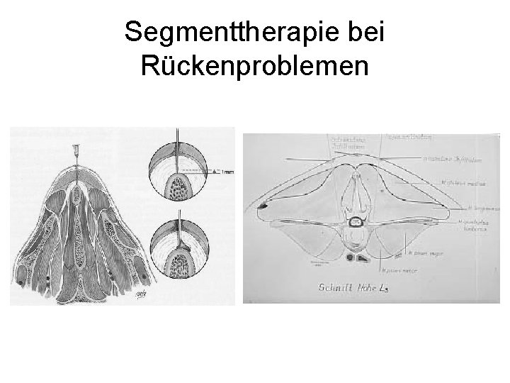 Segmenttherapie bei Rückenproblemen 