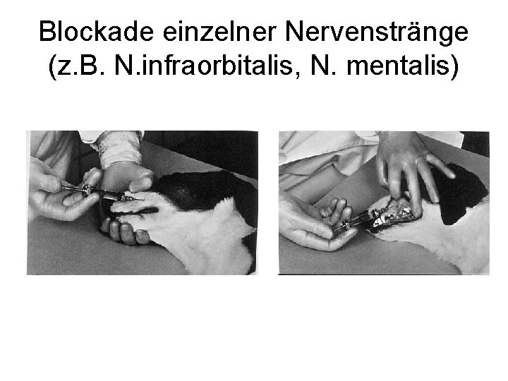 Blockade einzelner Nervenstränge (z. B. N. infraorbitalis, N. mentalis) 