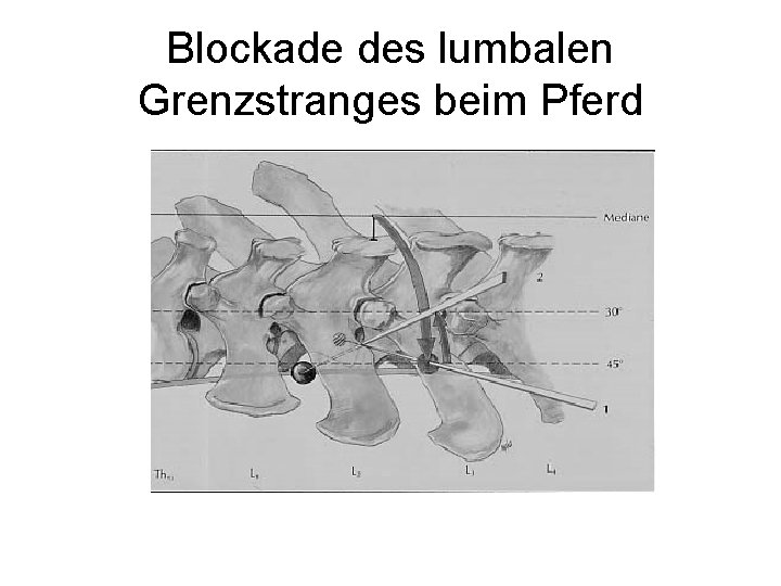 Blockade des lumbalen Grenzstranges beim Pferd 