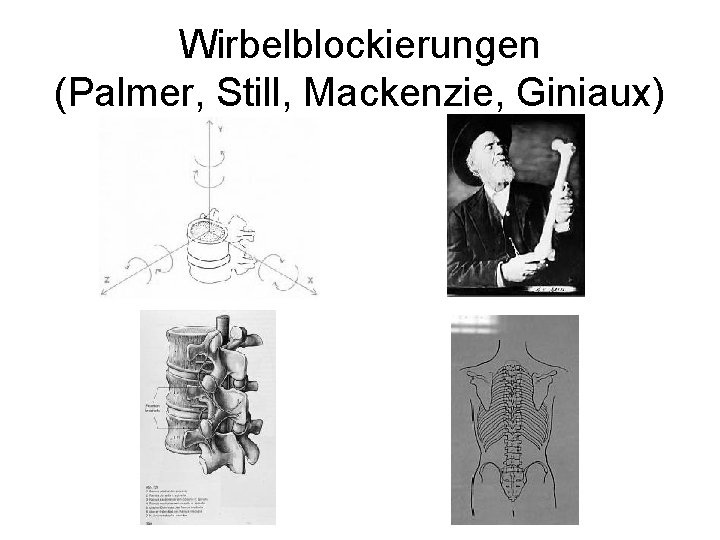 Wirbelblockierungen (Palmer, Still, Mackenzie, Giniaux) 