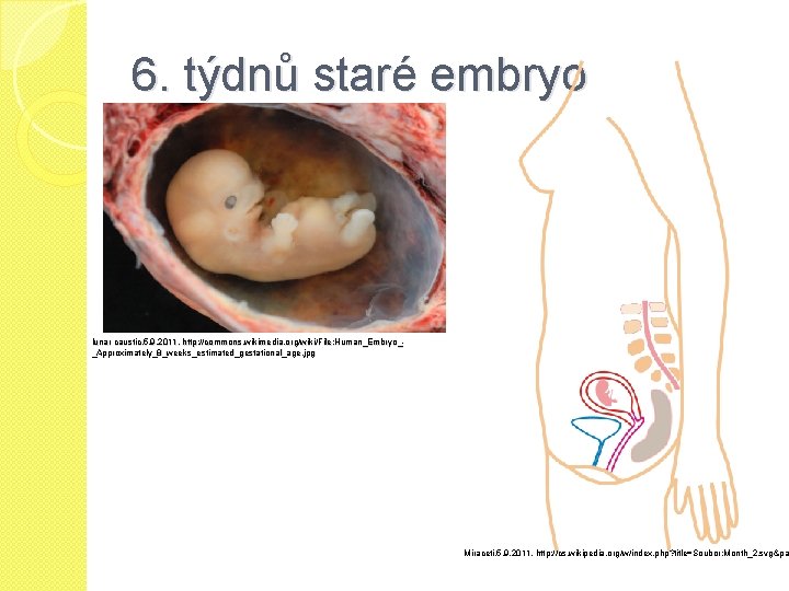 6. týdnů staré embryo lunar caustic, 5. 9. 2011, http: //commons. wikimedia. org/wiki/File: Human_Embryo__Approximately_8_weeks_estimated_gestational_age.