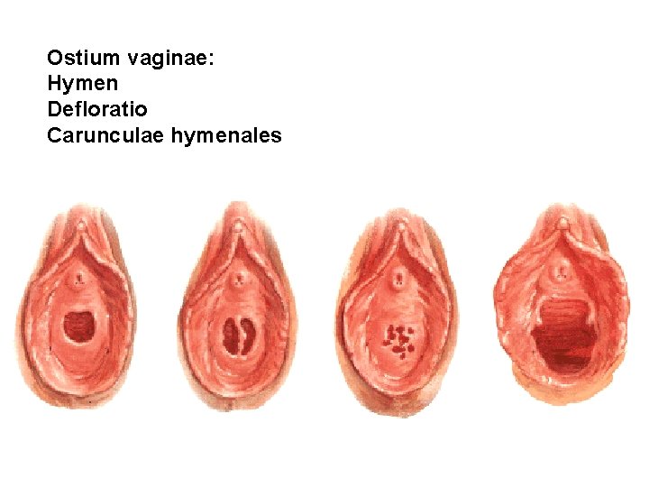 Ostium vaginae: Hymen Defloratio Carunculae hymenales 