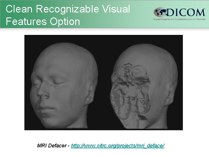 Clean Recognizable Visual Features Option MRI Defacer - http: //www. nitrc. org/projects/mri_deface/ 