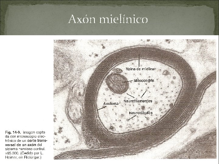 Axón mielínico 