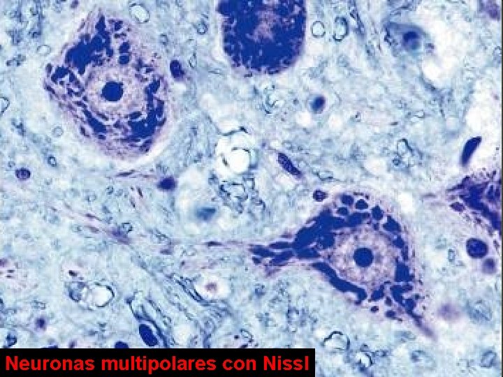 Neuronas multipolares con Nissl 