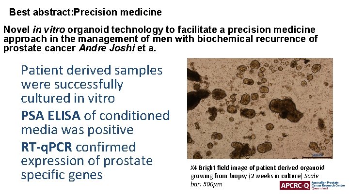 Best abstract: Precision medicine Novel in vitro organoid technology to facilitate a precision medicine