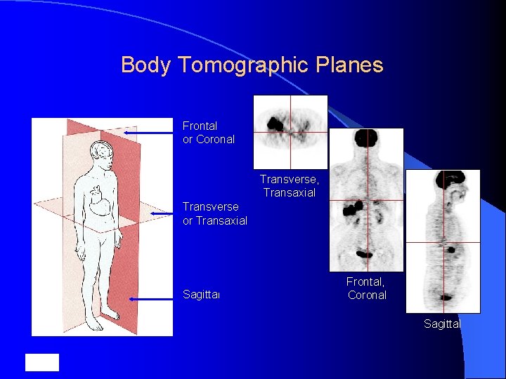 Body Tomographic Planes Frontal or Coronal Transverse, Transaxial Transverse or Transaxial Sagittal Frontal, Coronal