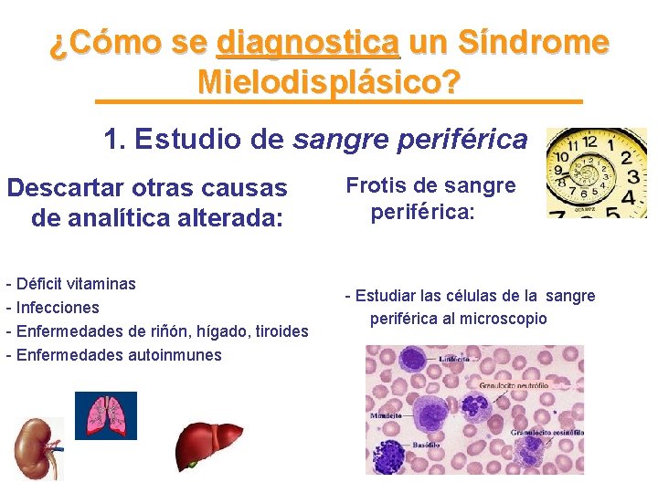 ¿Cómo se diagnostica un Síndrome Mielodisplásico? 1. Estudio de sangre periférica Descartar otras causas ¿Cómo se diagnostica un Síndrome Mielodisplásico? 1. Estudio de sangre periférica Descartar otras causas