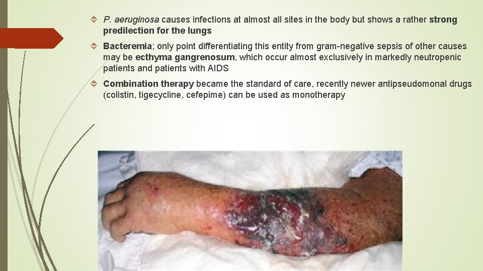  P. aeruginosa causes infections at almost all sites in the body but shows