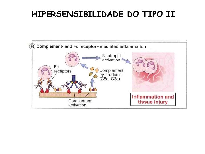 HIPERSENSIBILIDADE DO TIPO II 