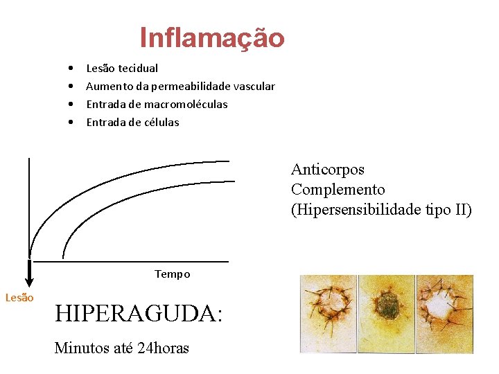 Inflamação • • Lesão tecidual Aumento da permeabilidade vascular Entrada de macromoléculas Entrada de