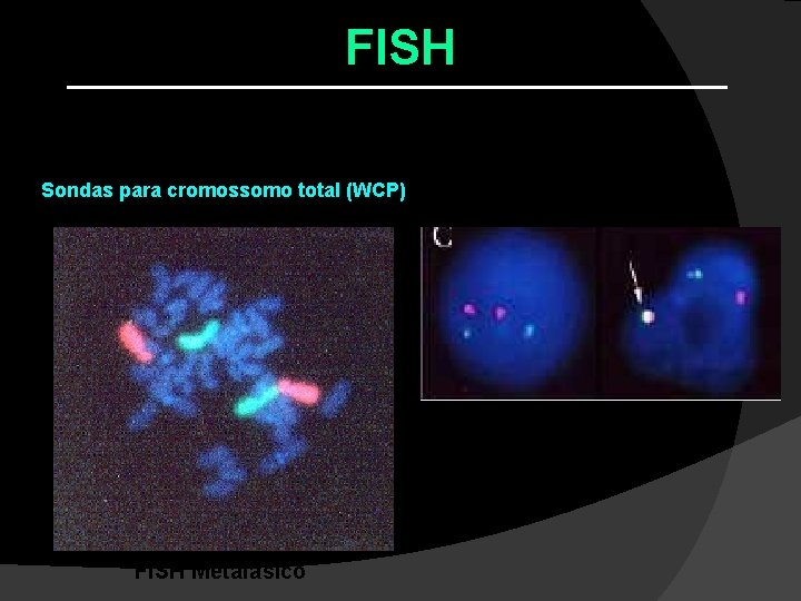FISH Tipos de Sondas: Sondas para cromossomo total (WCP) FISH Interfásico FISH Metafásico FISH Tipos de Sondas: Sondas para cromossomo total (WCP) FISH Interfásico FISH Metafásico