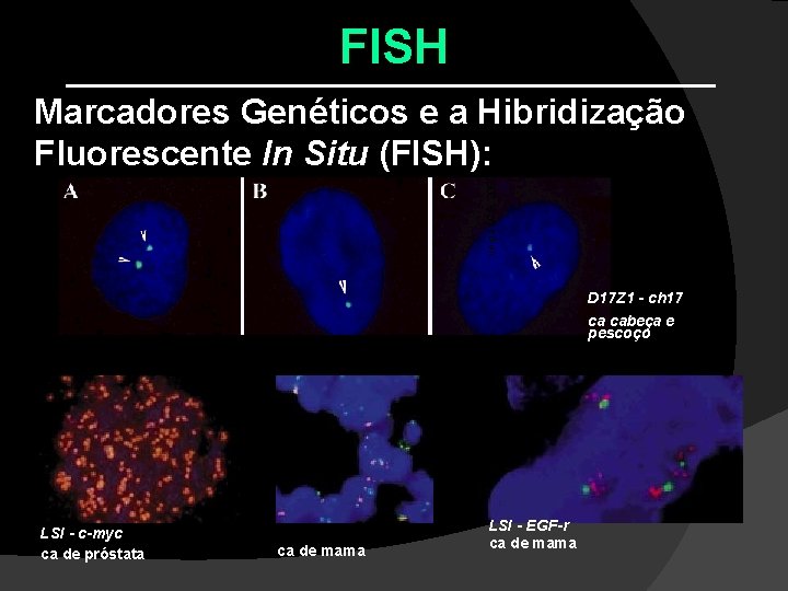 FISH Veiga LCS, 2003 Marcadores Genéticos e a Hibridização Fluorescente In Situ (FISH): D FISH Veiga LCS, 2003 Marcadores Genéticos e a Hibridização Fluorescente In Situ (FISH): D