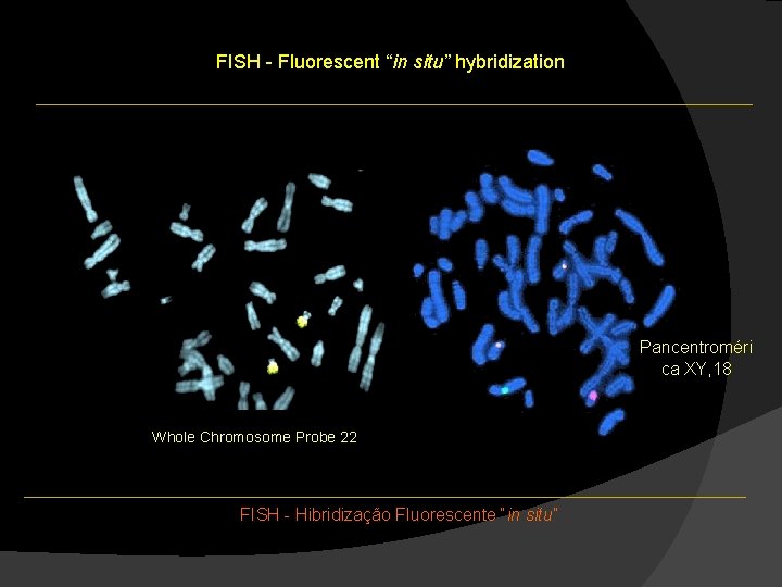 FISH - Fluorescent “in situ” hybridization Pancentroméri ca XY, 18 Whole Chromosome Probe 22 FISH - Fluorescent “in situ” hybridization Pancentroméri ca XY, 18 Whole Chromosome Probe 22