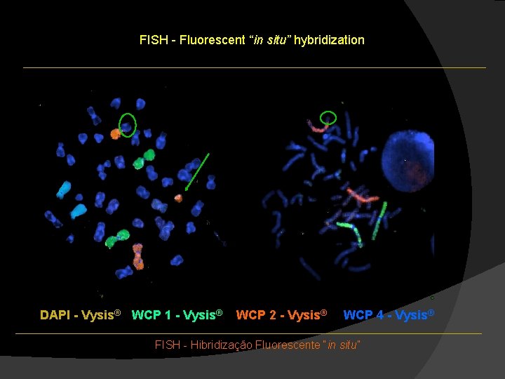 FISH - Fluorescent “in situ” hybridization DAPI - Vysis® / WCP 1 - Vysis® FISH - Fluorescent “in situ” hybridization DAPI - Vysis® / WCP 1 - Vysis®