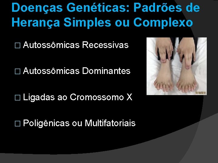 Doenças Genéticas: Padrões de Herança Simples ou Complexo � Autossômicas Recessivas � Autossômicas Dominantes Doenças Genéticas: Padrões de Herança Simples ou Complexo � Autossômicas Recessivas � Autossômicas Dominantes