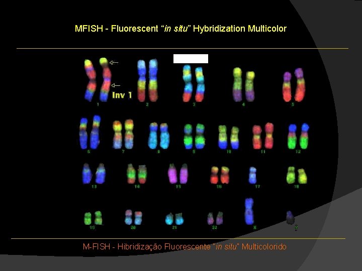 MFISH - Fluorescent “in situ” Hybridization Multicolor M-FISH - Hibridização Fluorescente “in situ” Multicolorido MFISH - Fluorescent “in situ” Hybridization Multicolor M-FISH - Hibridização Fluorescente “in situ” Multicolorido