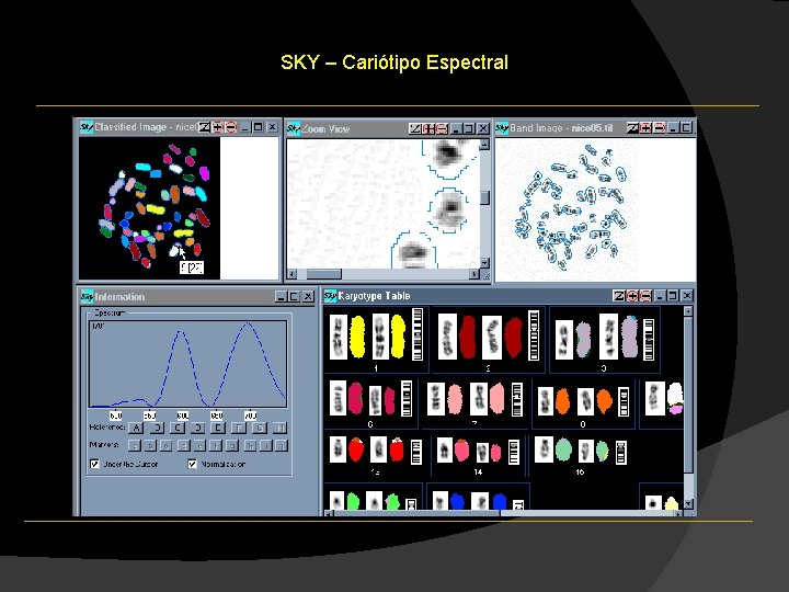 SKY – Cariótipo Espectral SKY – Cariótipo Espectral