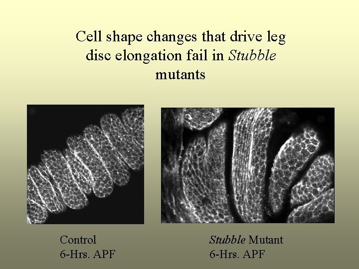 Cell shape changes that drive leg disc elongation fail in Stubble mutants Control 6