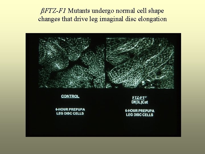ßFTZ-F 1 Mutants undergo normal cell shape changes that drive leg imaginal disc elongation