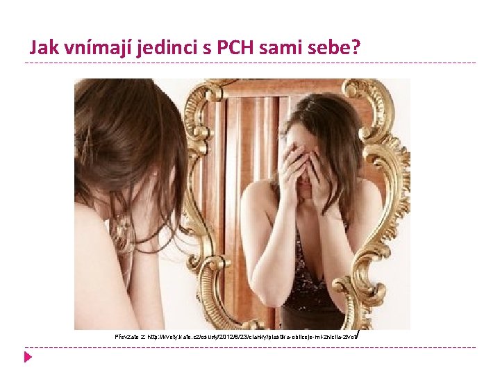 Jak vnímají jedinci s PCH sami sebe? Převzato z: http: //kvety. kafe. cz/osudy/2012/8/23/clanky/plastika-obliceje-mi-znicila-zivot /